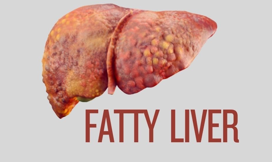 fatty liver mounjaro is it safe?