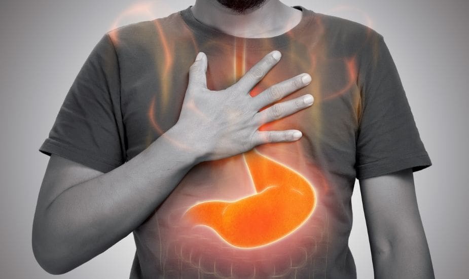 acid reflux on mounjaro